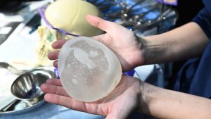 60.000 vrouwen wachten op uitspraak over gevaarlijke borstimplantaten in hoger beroep