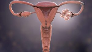 Miljoenen vrouwen herkennen eindelijk hun aandoening dankzij deze cruciale naamsverandering